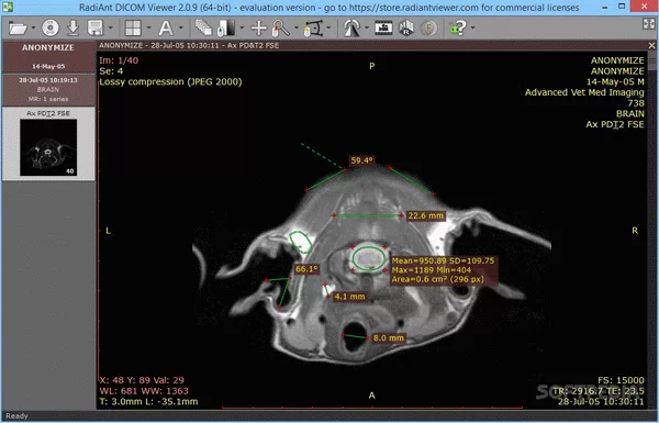 RadiAnt DICOM Viewer Crack + Activator Download 2023