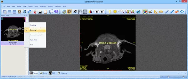 Sante DICOM Viewer Pro Activator Full Version